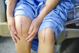 Advanced Knee Treatments